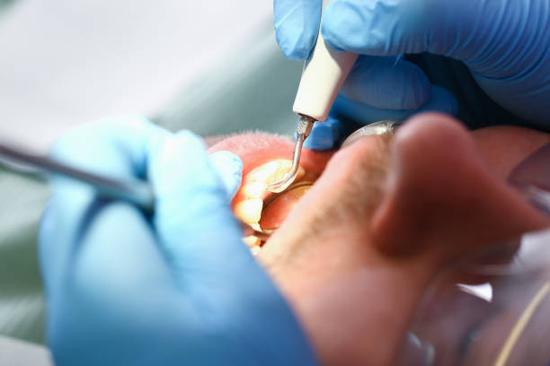 Best Emergency Dental Care for Sports Injuries in Eddyville, KY