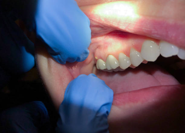 Best Emergency Orthodontic Repairs in Eddyville, KY