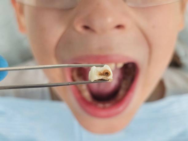 Best Emergency Care for Gum Disease in Eddyville, KY